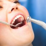 کامپوزیت دندان